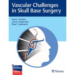 Vascular Challenges in...