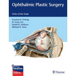 Ophthalmic Plastic Surgery:...