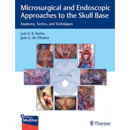 Microsurgical and Endoscopic Approaches to the Skull Base: Anatomy, Tactics, and Techniques