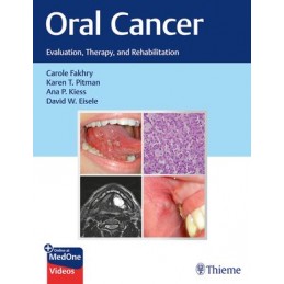 Oral Cancer: Evaluation, Therapy, and Rehabilitation