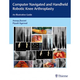 Computer Navigated and Handheld Robotic Knee Arthroplasty: An Illustrative Guide