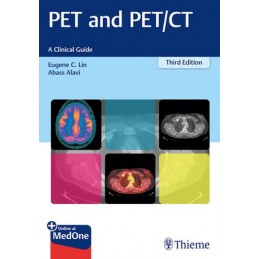 PET and PET/CT: A Clinical...