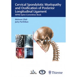 Cervical Spondylotic Myelopathy and Ossification of Posterior Longitudinal Ligament: WFNS Spine Committee Book