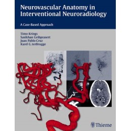 Neurovascular Anatomy in Interventional Neuroradiology: A Case-Based Approach