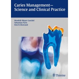 Caries Management - Science...