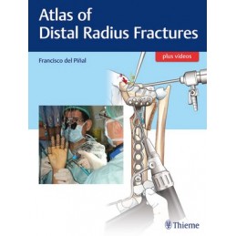 Atlas of Distal Radius...