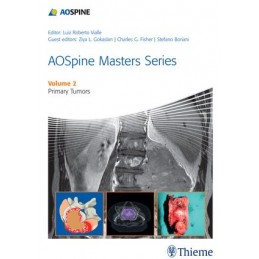 AOSpine Masters Series Volume 2: Primary Spinal Tumors