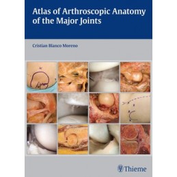 Atlas of Arthroscopic Anatomy of the Major Joints