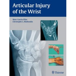 Articular Injury of the Wrist: FESSH 2014 Instructional Course Book