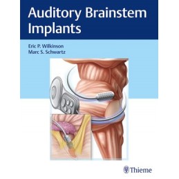 Auditory Brainstem Implants