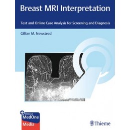 Breast MRI Interpretation: Text and Case Analysis for Screening and Diagnosis