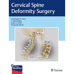 Cervical Spine Deformity...