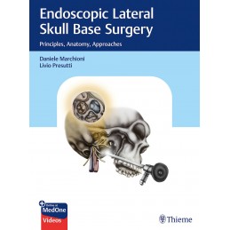 Endoscopic Lateral Skull...