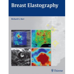 Breast Elastography