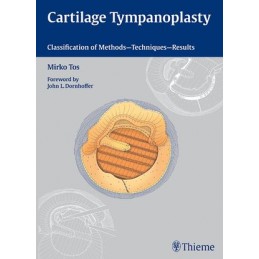Cartilage Tympanoplasty: Classification of Methods - Techniques - Results