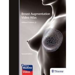 Breast Augmentation Video Atlas