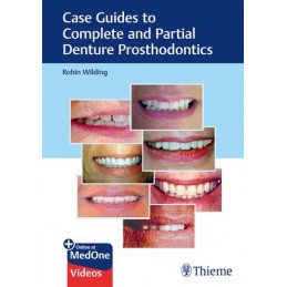 Case Guides to Complete and Partial Denture Prosthodontics