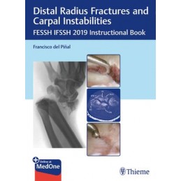 Distal Radius Fractures and Carpal Instabilities: FESSH IFSSH 2019 Instructional Book