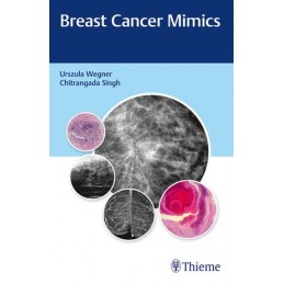 Breast Cancer Mimics