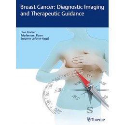 Breast Cancer: Diagnostic...