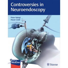 Controversies in Neuroendoscopy