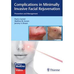 Complications in Minimally Invasive Facial Rejuvenation: Prevention and Management