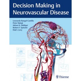 Decision Making in Neurovascular Disease
