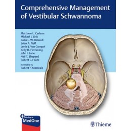 Comprehensive Management of Vestibular Schwannoma