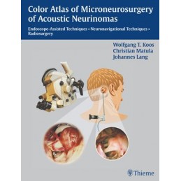 Color Atlas of Microsurgery of Acoustic Neurinomas: Endoscope-Assisted Techniques - Neuronavigational Techniques - Radiosurgery