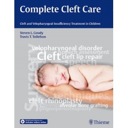 Complete Cleft Care: Cleft...