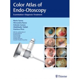 Color Atlas of Endo-Otoscopy: Examination - Diagnosis - Treatment