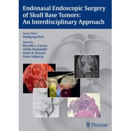 Endonasal Endoscopic Surgery of Skull Base Tumors: An Interdisciplinary Approach
