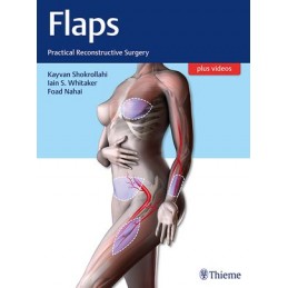 Flaps: Practical...