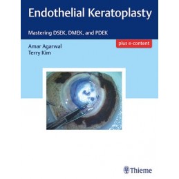 Endothelial Keratoplasty:...