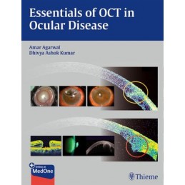 Essentials of OCT in Ocular...