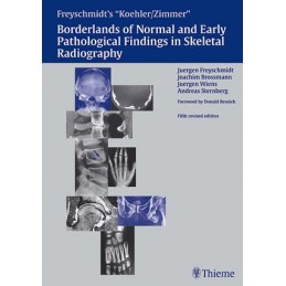 Freyschmidt's "Koehler/Zimmer" Borderlands of Normal and Early Pathological Findings in Skeletal Radiography