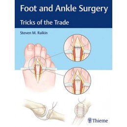 Foot and Ankle Surgery:...