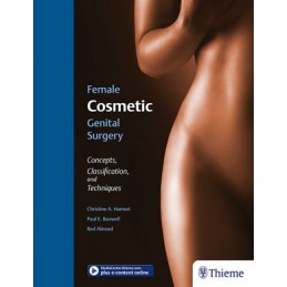 Female Cosmetic Genital Surgery: Concepts, classification, and techniques