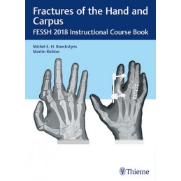 Fractures of the Hand and...