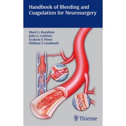 Handbook of Bleeding and...