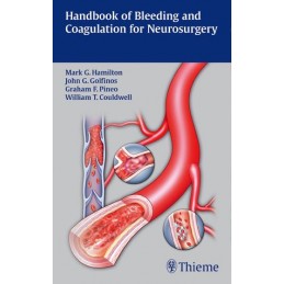 Handbook of Bleeding and Coagulation for Neurosurgery