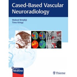 Imaging in Neurovascular Disease: A Case-Based Approach