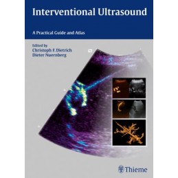 Interventional Ultrasound:...