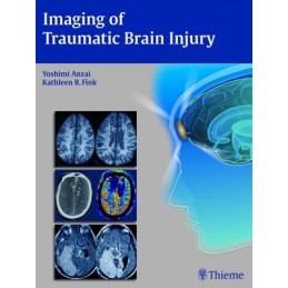 Imaging of Traumatic Brain...