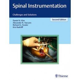 Spinal Instrumentation:...