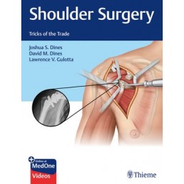 Shoulder Surgery: Tricks of the Trade