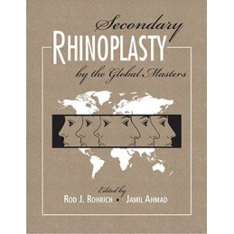 Secondary Rhinoplasty by...