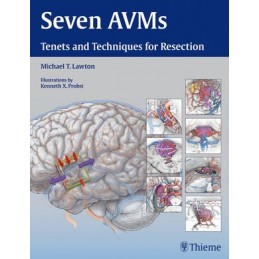 Seven AVMs: Tenets and...