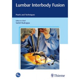 Lumbar Interbody Fusion: Pearls and Techniques
