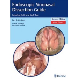 Endoscopic Sinonasal Dissection Guide: Including Orbit and Skull Base